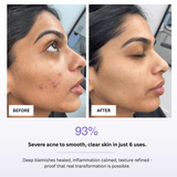 GlowLift Ice Facial Bowl