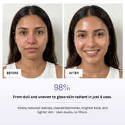 GlowLift Ice Facial Bowl
